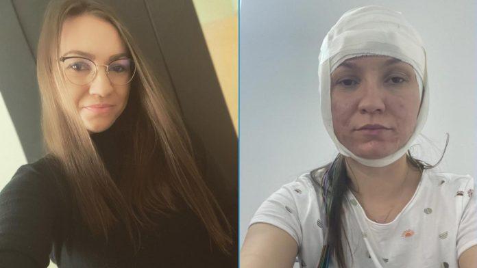 Donează ACUM, salvează o viață! La doar 17 ani, Ioana trăiește cu o epilepsie ce se poate declanșa în orice moment