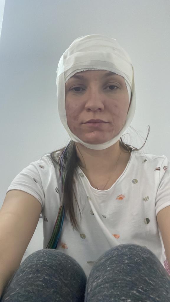 Donează ACUM, salvează o viață! La doar 17 ani, Ioana trăiește cu o epilepsie ce se poate declanșa în orice moment