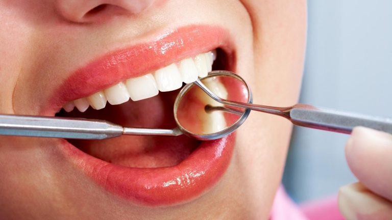 SPECIAL. Leziunile dentare: Înțelegerea cauzelor, consecințelor și a modului de prevenire